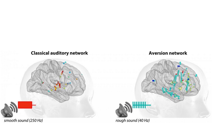 Un son « d’alarme » (entre 40 et 80 Hz) sollicite un grand nombre de régions corticales et sous-corticales qui n'appartiennent pas au système auditif classique 