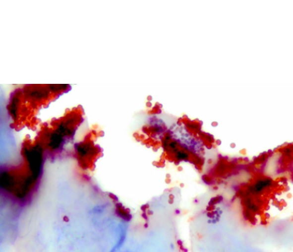 Aucune étude n’avait encore évalué les effets du sécrétome des CSM sur les mécanismes de défense antimicrobienne des cellules de la peau ou sur des biofilms bactériens (Visuel AlphaMed Press) Aucune étude n’avait encore évalué les effets du sécrétome des CSM sur les mécanismes de défense antimicrobienne des cellules de la peau ou sur des biofilms bactériens (Visuel AlphaMed Press)