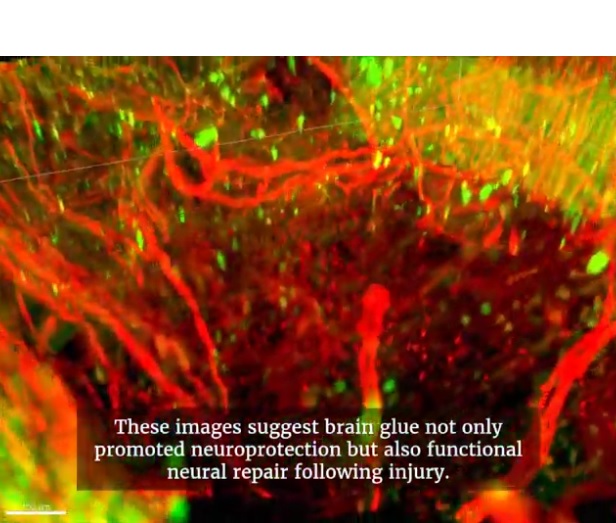 A l’aide d’une technique d'imagerie 3D, les scientifiques ont pu capturer visuellement la réponse immédiate des cellules des sites traités (Visuel UGA) A l’aide d’une technique d'imagerie 3D, les scientifiques ont pu capturer visuellement la réponse immédiate des cellules des sites traités (Visuel UGA)