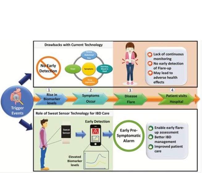 Le dispositif semblable à un bracelet détecte 2 biomarqueurs clés associés à la MICI, l'interleukine-1β et la protéine C-réactive (CRP) (Schéma Université du Texas à Dallas) Le dispositif semblable à un bracelet détecte 2 biomarqueurs clés associés à la MICI, l'interleukine-1β et la protéine C-réactive (CRP) (Schéma Université du Texas à Dallas)