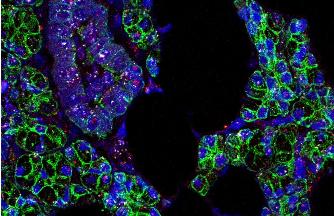 L’ARN du SRAS-CoV-2 (en rose) et du récepteur ACE2 (en blanc) est identifié dans les cellules des glandes salivaires humaines (en vert) (Visuel Paola Perez, PhD, Warner Lab, NIDCR)
