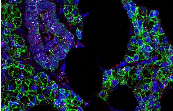 L’ARN du SRAS-CoV-2 (en rose) et du récepteur ACE2 (en blanc) est identifié dans les cellules des glandes salivaires humaines (en vert) (Visuel Paola Perez, PhD, Warner Lab, NIDCR) L’ARN du SRAS-CoV-2 (en rose) et du récepteur ACE2 (en blanc) est identifié dans les cellules des glandes salivaires humaines (en vert) (Visuel Paola Perez, PhD, Warner Lab, NIDCR)