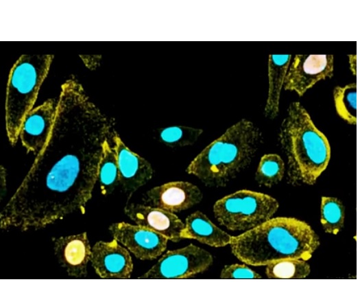 Les cellules sénescentes ont souvent 2 noyaux et elles ne synthétisent plus l'ADN.