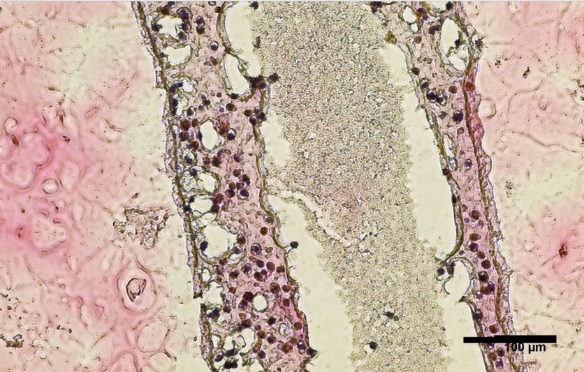 Les cellules ont été cultivées et imprimées en 3D dans ne boîte de Pétri dans une structure tubulaire creuse qui ressemble aux tubes séminifères humains producteurs de sperme (Visuel Courtesy of Dr. Ryan Flannigan) Les cellules ont été cultivées et imprimées en 3D dans ne boîte de Pétri dans une structure tubulaire creuse qui ressemble aux tubes séminifères humains producteurs de sperme (Visuel Courtesy of Dr. Ryan Flannigan)