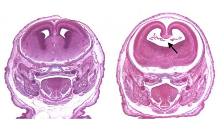 Ces 2 substances interagissent au niveau cellulaire en perturbant la signalisation entre molécules et cellules qui contrôlent la croissance et le développement