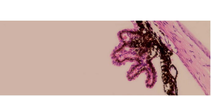 coupe histologique du corps ciliaire coupe histologique du corps ciliaire