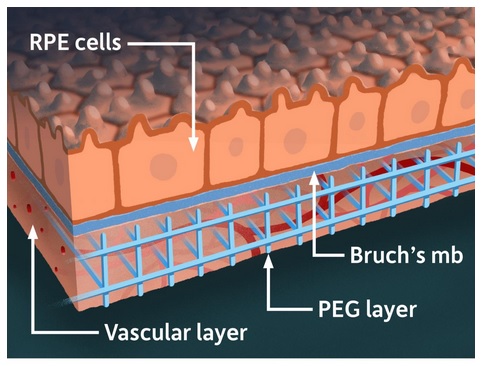 Le modèle combine des tissus rétiniens dérivés de cellules souches et des réseaux vasculaires de patients humains reproduits avec des matériaux synthétiques, dans une « matrice » tridimensionnelle (Illustration de l'Université de Rochester / Michael Osadciw)
