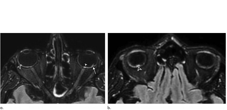 Visuel Radiological Society of North America Visuel Radiological Society of North America