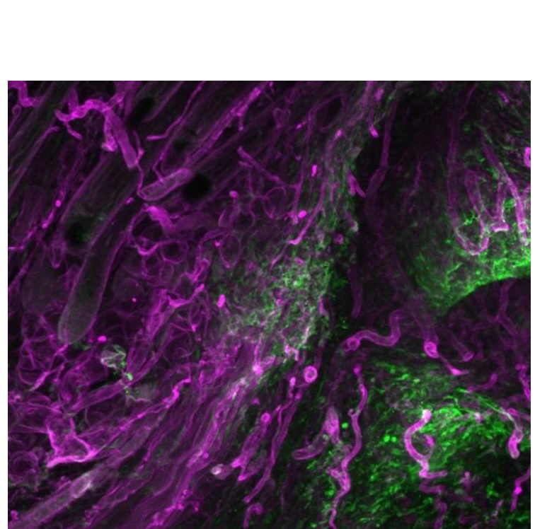 Les cellules fascia (en vert sur visuel) émergent dans des plaies cutanées ouvertes avec leur matrice environnante (en rouge). Les cellules fascia (en vert sur visuel) émergent dans des plaies cutanées ouvertes avec leur matrice environnante (en rouge).