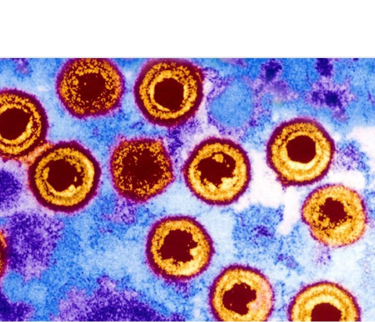 L'herpès génital, également appelé virus de l'herpès simplex de type 2 ou HSV-2, est la maladie transmise sexuellement la plus répandue. L'herpès génital, également appelé virus de l'herpès simplex de type 2 ou HSV-2, est la maladie transmise sexuellement la plus répandue.