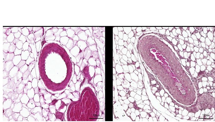 Dr. Q. Fatimunnisa, Bader Lab, MDC Dr. Q. Fatimunnisa, Bader Lab, MDC