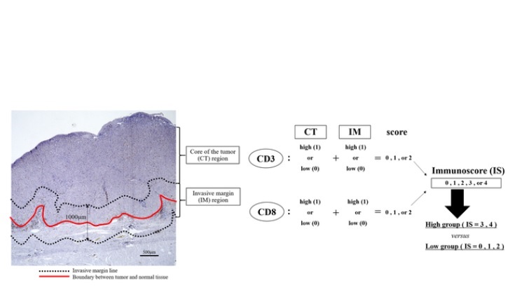 (Visuel © 2021 Toshiki Noma et al., Annals of Surgery)