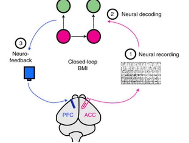 Lorsque les signaux de douleur sont détectés, l'ordinateur déclenche une stimulation thérapeutique d'une autre zone du cerveau, le cortex préfrontal, qui apporte un soulagement (Visuel  Nature Biomedical Engineering)