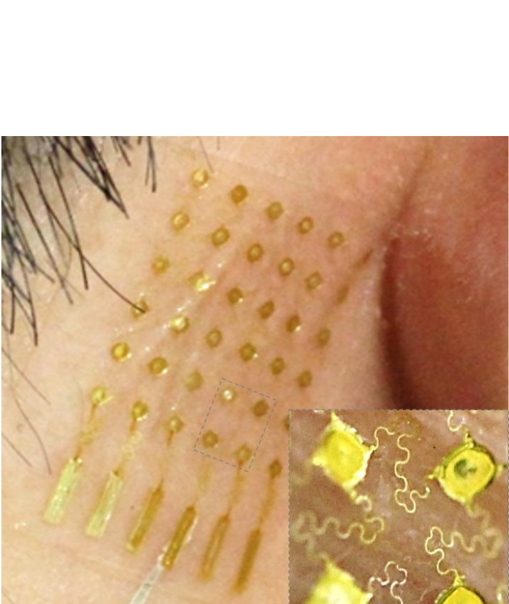 Le sujet porte une électronique sans fil flexible adaptée à la nuque, avec des électrodes maintenues par un bandeau en tissu et une électrode à nano-membrane sur la mastoïde Le sujet porte une électronique sans fil flexible adaptée à la nuque, avec des électrodes maintenues par un bandeau en tissu et une électrode à nano-membrane sur la mastoïde