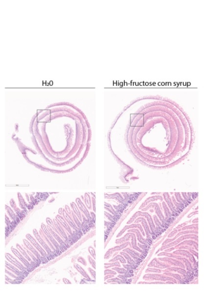Les souris nourries avec un régime riche en fructose présentent des villosités intestinales plus longues (Visuel Samuel Taylor and Dr. Marcus Goncalves) Les souris nourries avec un régime riche en fructose présentent des villosités intestinales plus longues (Visuel Samuel Taylor and Dr. Marcus Goncalves)