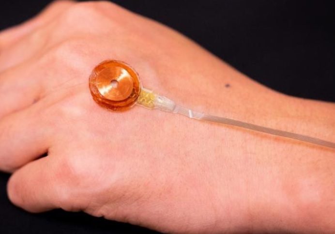 C’est donc un nouveau modèle portable d’aide au diagnostic et à la surveillance de la réponse au traitement (Visuel Dr Yu Xinge's team) C’est donc un nouveau modèle portable d’aide au diagnostic et à la surveillance de la réponse au traitement (Visuel Dr Yu Xinge's team)