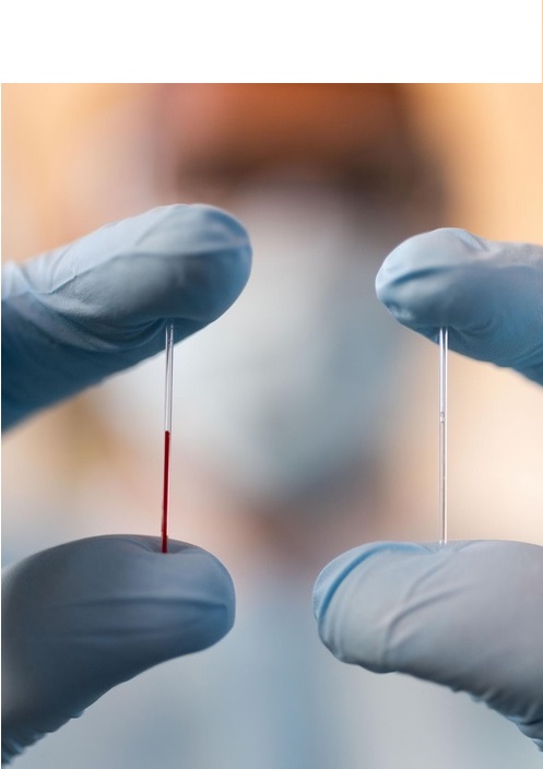 Il fallait trouver un moyen d’extraction de ce fluide corporel encore inexploré et pourtant riche de biomarqueurs (Allison Carter, Georgia Tech) Il fallait trouver un moyen d’extraction de ce fluide corporel encore inexploré et pourtant riche de biomarqueurs (Allison Carter, Georgia Tech)