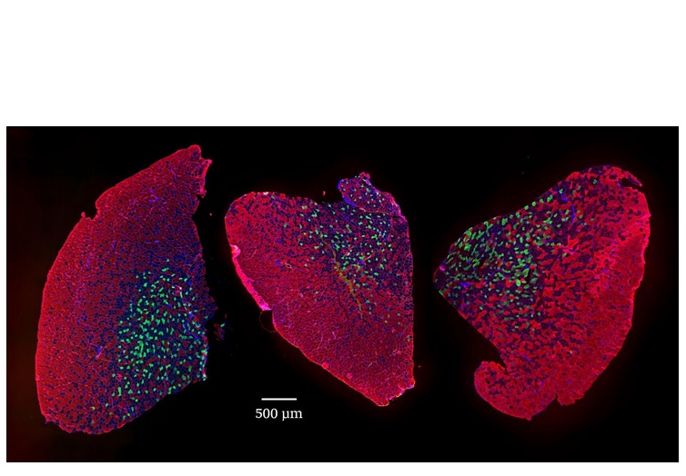  Muscle de souris jeune à gauche, âgée au centre, traité par rapamycine à droite- Visuel University of Basel, Biozentrum