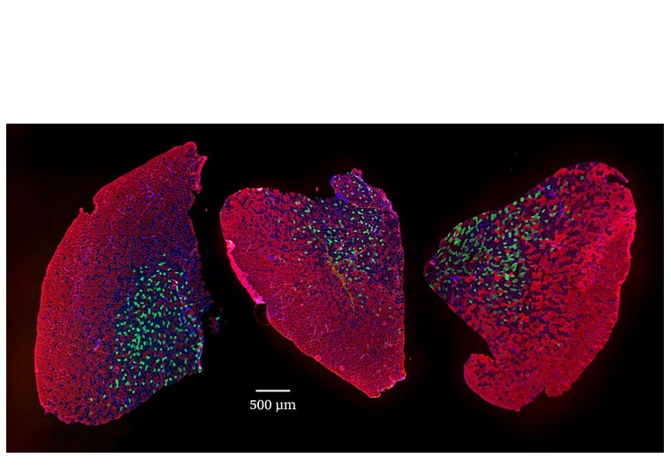 Muscle de souris jeune à gauche, âgée au centre, traité par rapamycine à droite- Visuel University of Basel, Biozentrum Muscle de souris jeune à gauche, âgée au centre, traité par rapamycine à droite- Visuel University of Basel, Biozentrum