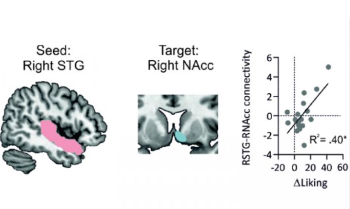 La connexion entre circuits cérébraux auditifs et de la récompense sous-tend le plaisir musical (Visuel Mas-Herrero et al., JNeurosci 2021)