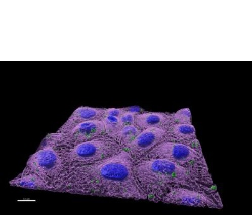 Nanoplastiques dans des cellules intestinales de poisson-zèbre (Visuel UAB / CREAF) Nanoplastiques dans des cellules intestinales de poisson-zèbre (Visuel UAB / CREAF)