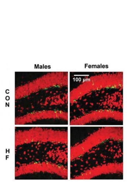 Cependant il reste à mieux comprendre cet effet sexospécifique de l'excès de graisse sur le cerveau. 