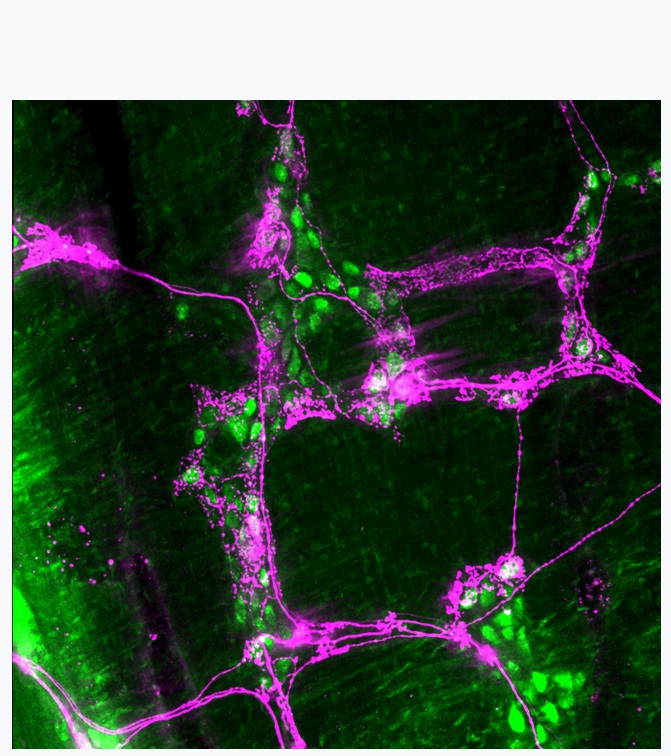 La stimulation de ces neurones dans l’intestin est plus efficace à éliminer l’appétit que la stimulation des mêmes récepteurs dans l’estomac La stimulation de ces neurones dans l’intestin est plus efficace à éliminer l’appétit que la stimulation des mêmes récepteurs dans l’estomac