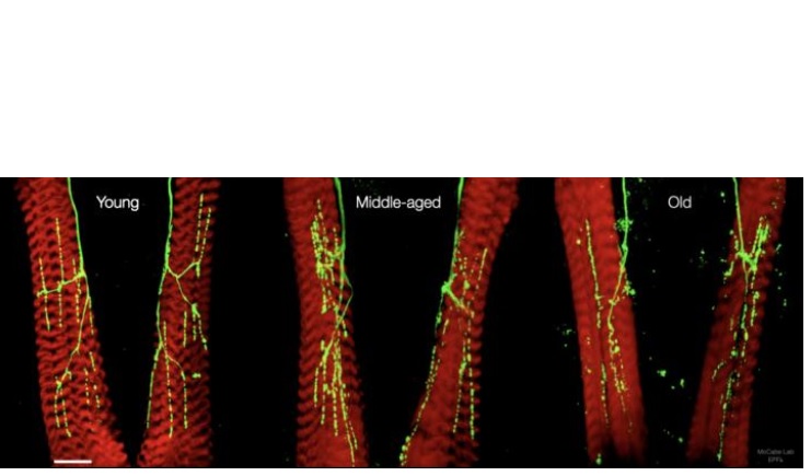 « La capacité motrice diminue chez tous les animaux vieillissants, y compris les humains, c’est donc une excellente surprise de voir qu’il est possible de freiner ce processus » (Visuel © Laboratory of Neural Genetics and Disease / EPFL) « La capacité motrice diminue chez tous les animaux vieillissants, y compris les humains, c’est donc une excellente surprise de voir qu’il est possible de freiner ce processus » (Visuel © Laboratory of Neural Genetics and Disease / EPFL)