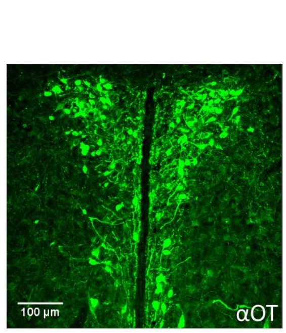 Cellules productrices d'ocytocine dans le noyau paraventriculaire d'un hypothalamus de souris Cellules productrices d'ocytocine dans le noyau paraventriculaire d'un hypothalamus de souris