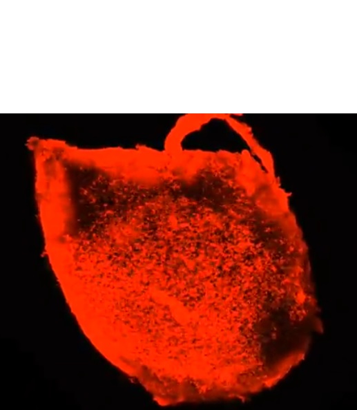 Les plaques apparaissent dans les structures cérébrales profondes, puis suivent des circuits spécifiques pour se répandre dans le cerveau au bout de 6 à 12 mois Les plaques apparaissent dans les structures cérébrales profondes, puis suivent des circuits spécifiques pour se répandre dans le cerveau au bout de 6 à 12 mois