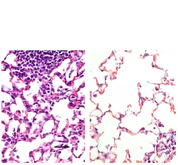 Tissu pulmonaire : vaccination par injection intra-musculaire à gauche et par voie nasale à droite (Visuel Hassan et al.)