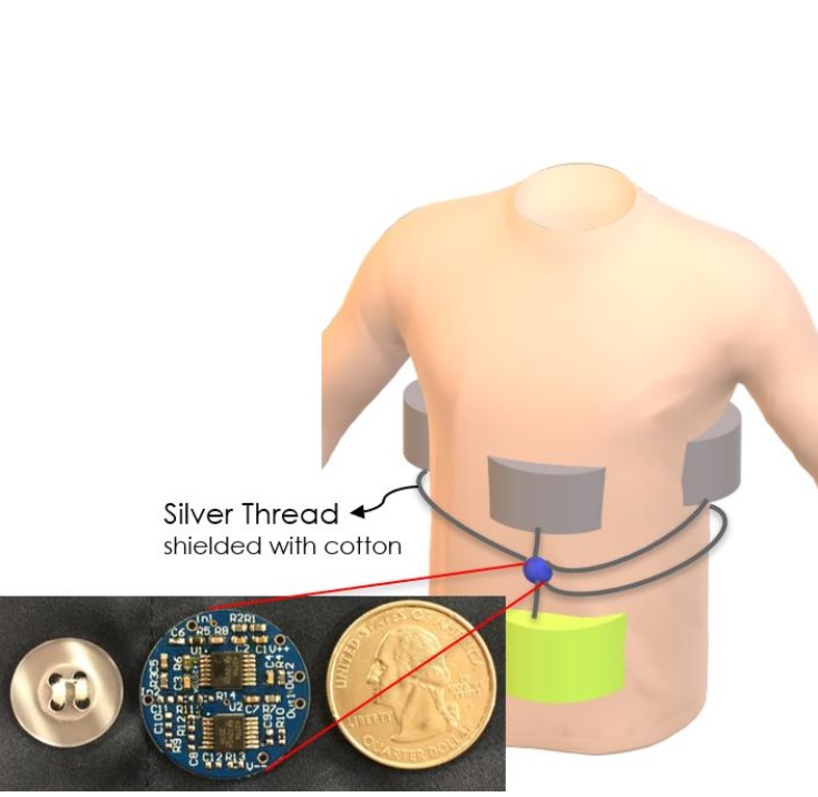 L’équipe a conçu un nouveau capteur de pression associé à un capteur triboélectrique (activé par un changement de contact physique) pouvant être intégré à des vêtements amples tels qu'un pyjama. L’équipe a conçu un nouveau capteur de pression associé à un capteur triboélectrique (activé par un changement de contact physique) pouvant être intégré à des vêtements amples tels qu'un pyjama.