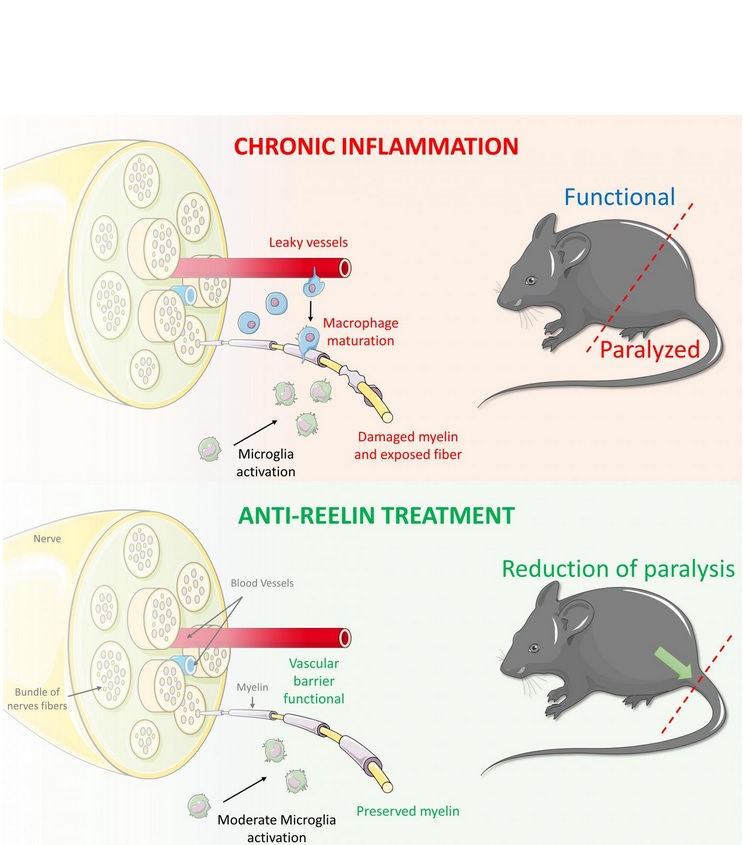 Des anticorps inactivant la reeline préviennent la paralysie chez des souris modèles de SEP (UT Southwestern Medical Center) Des anticorps inactivant la reeline préviennent la paralysie chez des souris modèles de SEP (UT Southwestern Medical Center)