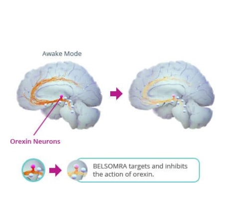 Les antagonistes des récepteurs de l’orexine (DORA) ciblent plus sélectivement les voies de sommeil / veille du cerveau