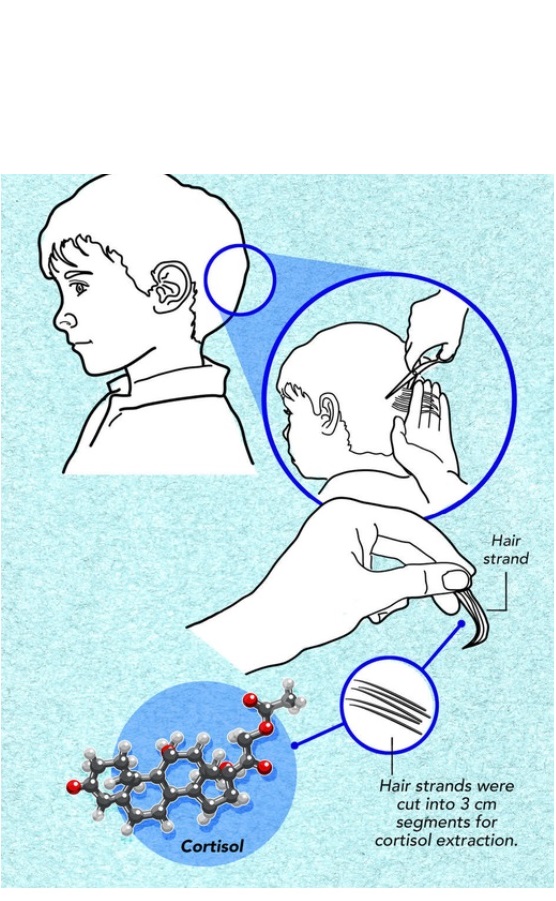 L’analyse révèle une concentration accrue de cortisol dans les cheveux des enfants, confirmant des niveaux de stress élevés lors des 3 premiers mois de pandémie (Visuel NYU Abu Dhabi) L’analyse révèle une concentration accrue de cortisol dans les cheveux des enfants, confirmant des niveaux de stress élevés lors des 3 premiers mois de pandémie (Visuel NYU Abu Dhabi)