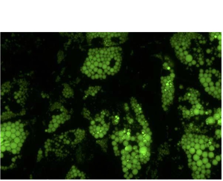 Les cellules adipeuses brunes « saines » (en vert sur le visuel ) ont besoin de beaucoup « d’hème » pour métaboliser correctement les aliments.