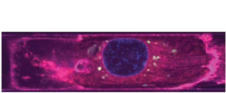 VEs dérivés de l'endothélium (vert) autour des noyaux (bleu) d'un cardiomyocyte (magenta) (Visuel Disease Biophysics Group / Harvard SEAS) 