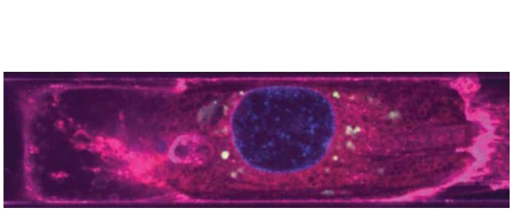 VEs dérivés de l'endothélium (vert) autour des noyaux (bleu) d'un cardiomyocyte (magenta) (Visuel Disease Biophysics Group / Harvard SEAS) VEs dérivés de l'endothélium (vert) autour des noyaux (bleu) d'un cardiomyocyte (magenta) (Visuel Disease Biophysics Group / Harvard SEAS)