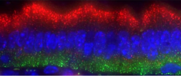 La muqueuse diffère de chaque côté (vert et rouge) au niveau cellulaire (en bleu) dans la composition de l'ARN messager La muqueuse diffère de chaque côté (vert et rouge) au niveau cellulaire (en bleu) dans la composition de l'ARN messager