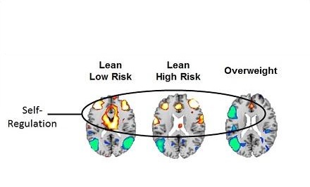 L'étude montre une réduction de l’activité dans les circuits qui supportent l'autorégulation et l'attention chez les adolescents en surpoids et à risque familial d'obésité. L'étude montre une réduction de l’activité dans les circuits qui supportent l'autorégulation et l'attention chez les adolescents en surpoids et à risque familial d'obésité.