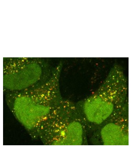 Processus d'autophagie dans les cellules. Points verts et jaunes: autophagosomes; points rouges: autophagosomes fusionnés avec des lysosomes Processus d'autophagie dans les cellules. Points verts et jaunes: autophagosomes; points rouges: autophagosomes fusionnés avec des lysosomes