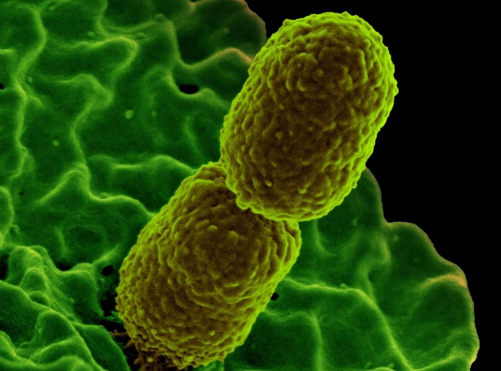 La taurine protège ici les souris de l’infection à Klebsiella pneumoniae résistante aux carbapénèmes (Visuel NIAID)