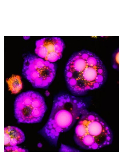 Les cellules privées de cuivre ont une taille 2 fois supérieure à celle de leurs homologues saines. De plus ces cellules contiennent plus de molécules de lipides. Les cellules privées de cuivre ont une taille 2 fois supérieure à celle de leurs homologues saines. De plus ces cellules contiennent plus de molécules de lipides.