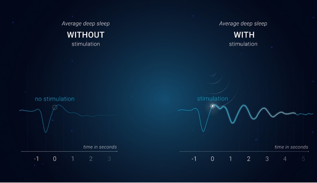 En amplifiant vos ondes lentes au bon moment, Dreem étend et amplifie votre sommeil profond. En amplifiant vos ondes lentes au bon moment, Dreem étend et amplifie votre sommeil profond.