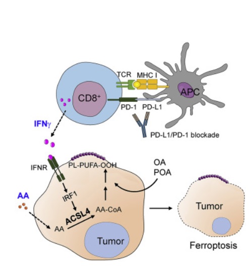 Une cytokine combinée à un acide gras, l'acide arachidonique, conduit à un type de mort cellulaire appelé ferroptose, en ciblant l'enzyme ACSL4 (Visuel Cancer Cell) Une cytokine combinée à un acide gras, l'acide arachidonique, conduit à un type de mort cellulaire appelé ferroptose, en ciblant l'enzyme ACSL4 (Visuel Cancer Cell)