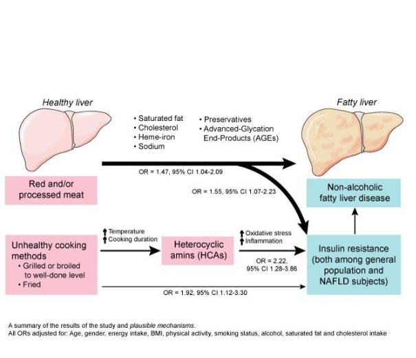 une consommation élevée de viande rouge et transformée indépendamment associée à la stéatose hépatique non alcoolique et à la résistance à l'insuline