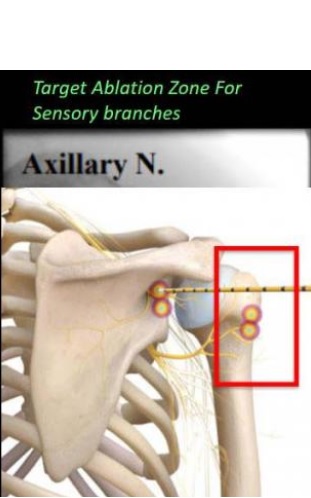 Visuel Radiological Society of North America Visuel Radiological Society of North America