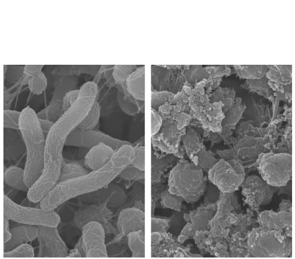 Ce nouveau polymère agrémenté de chaines protéiques, capable de cibler et Ce nouveau polymère agrémenté de chaines protéiques, capable de cibler et tuer les bactéries Helicobacter pylori dans l'estomac sans tuer les bactéries utiles du microbiote intestinal