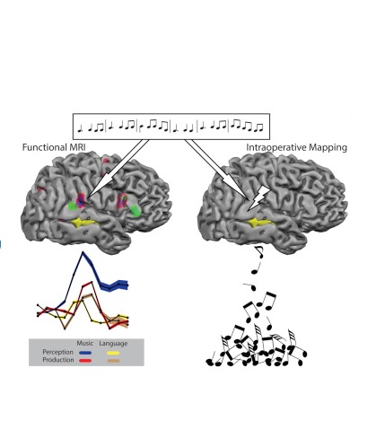 Avec la collaboration d’experts musiciens, l’équipe a donc développé une série de tests cognitifs et musicaux à effectuer par le patient Avec la collaboration d’experts musiciens, l’équipe a donc développé une série de tests cognitifs et musicaux à effectuer par le patient