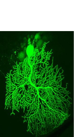 Neurone de Purkinje de souris affecté par l'exposition à la nicotine